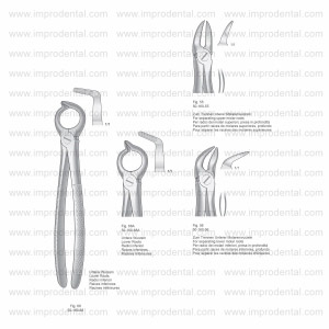 Extracting Forceps, English Pattern